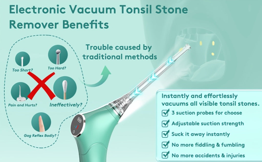 Tonsil Stone Remover Electric Vacuum Kit, Built-In LED Light, 3 Suction Modes & 5X Magnifying Mirror, Oral